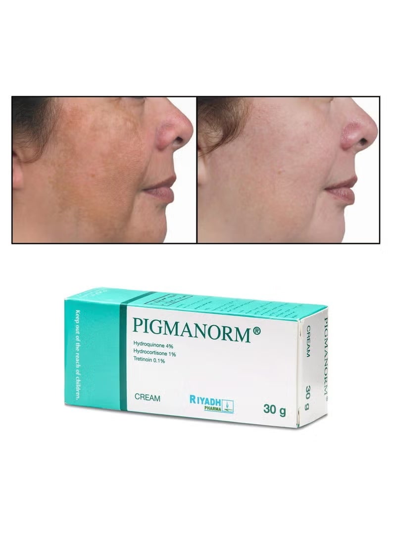 RIYADH PHARMA Pigmanorm Cream 30 Ml - Image 3
